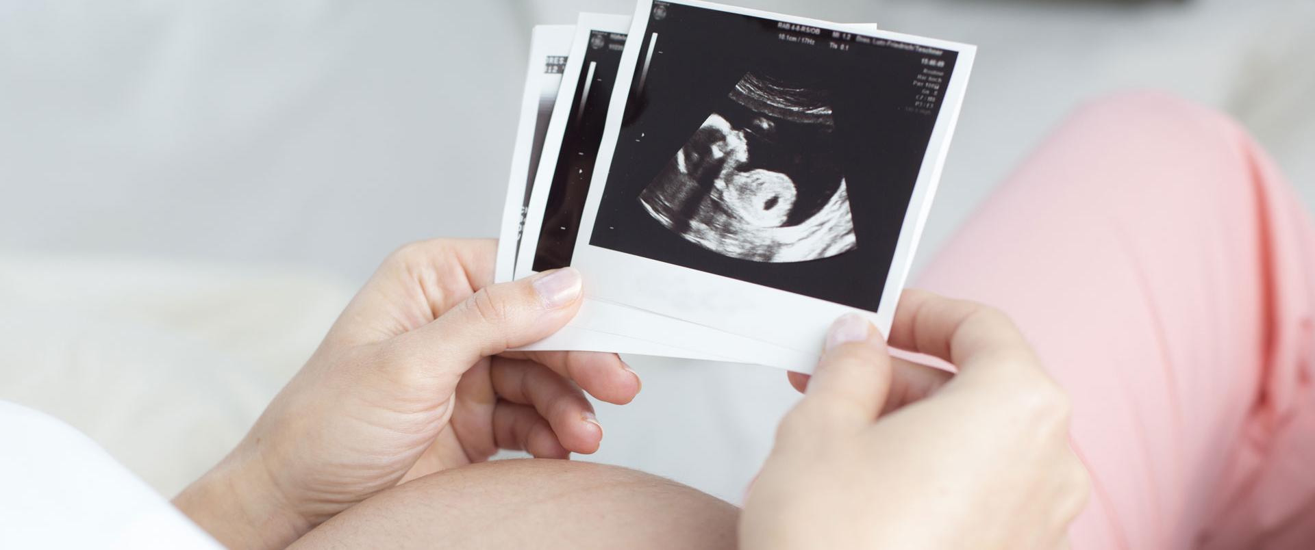 Schwangere Frau schaut sich ein Ultraschallbild an