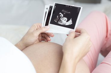 Schwangere Frau schaut sich ein Ultraschallbild an