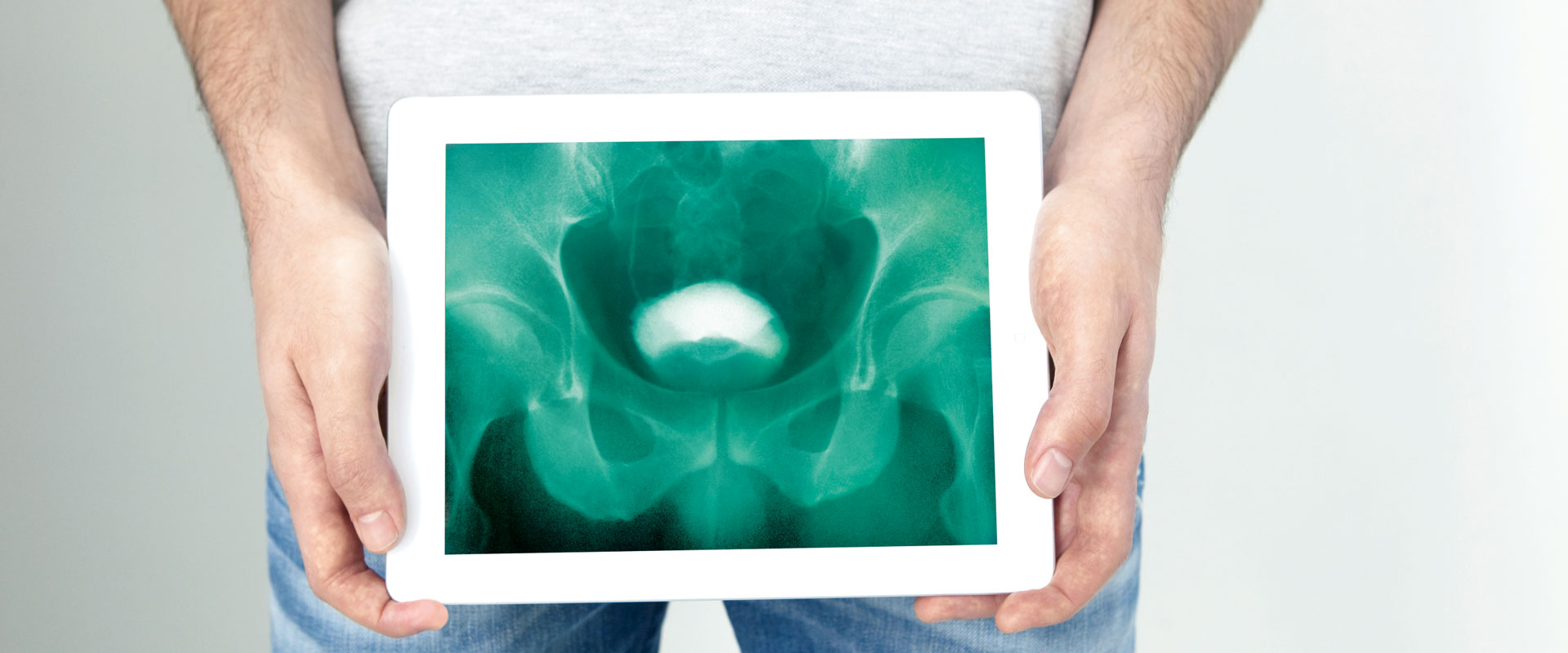 Röntgenbild von der Blase und Prostata